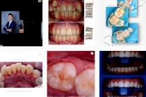 Качественное оказание услуг в стоматологии «DENTIS»